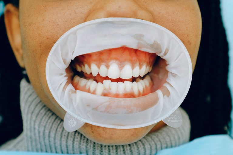 The Importance of Good Oral Health