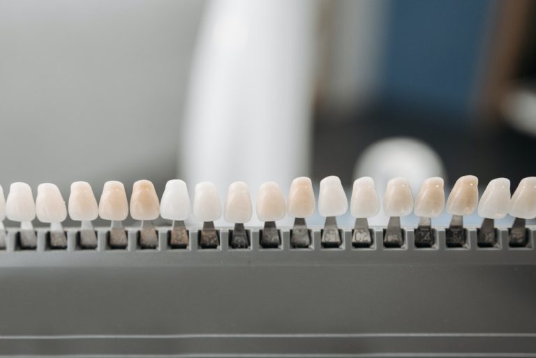 The Top Reasons to Get Dental Veneers