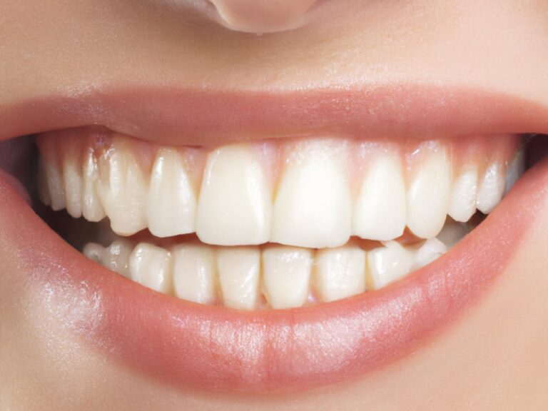 How Composite Bonding Can Restore Tooth Strength and Function